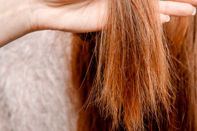 الشعر المتقصف