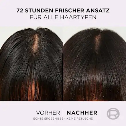 Thumbnail of بلسم هيدرا هيالورونيك بيور من لوريال باريس إلفيتال للفروة الدهنية والشعر الجاف