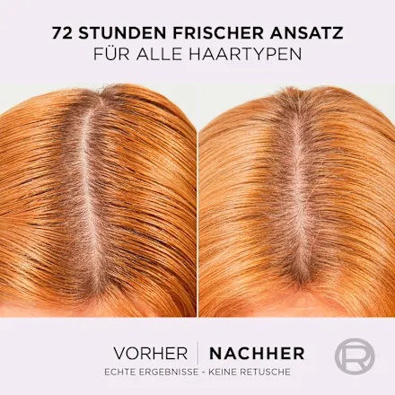 Thumbnail of لوريال باريس إلفيتال سيروم الشعر هيدرا هيالورونيك بيور، 102 مل